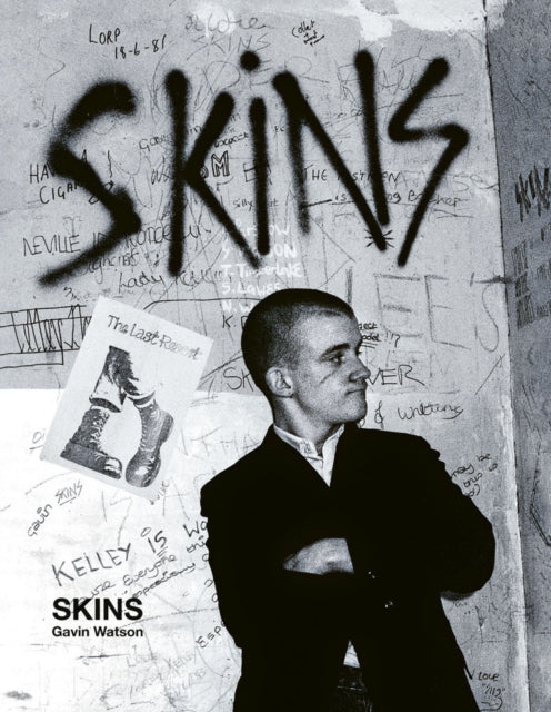 Book cover of: Skins. By: WATSON