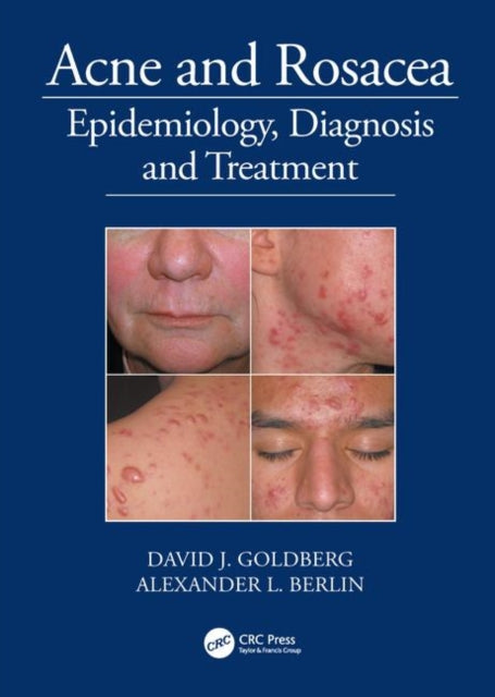 Book cover of: Acne and Rosacea. By: David J Goldberg