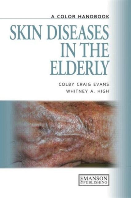 Book cover of: Skin Diseases in the Elderly. By: Colby C. Evans