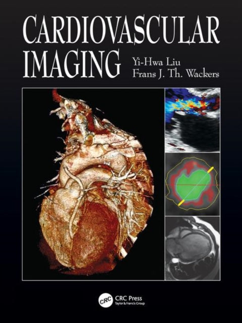 Book cover of: Cardiovascular Imaging. By: Yi-Hwa Liu