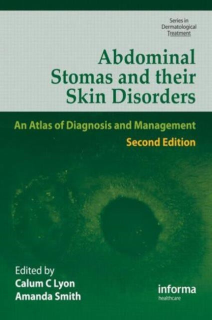 Book cover of: Abdominal Stomas and Their Skin Disorders