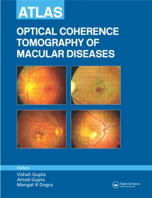Book cover of: Atlas of Optical Coherence Tomography of Macular Diseases. By: Vishali Gupta