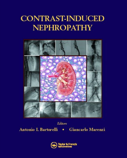 Book cover of: Contrast-Induced Nephropathy in Interventional Cardiovascular Medicine