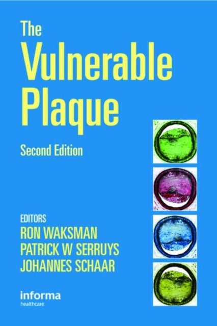 Book cover of: Handbook of the Vulnerable Plaque