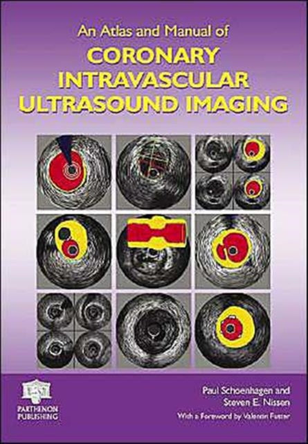 Book cover of: Atlas and Manual of Coronary Intravascular Ultrasound Imaging