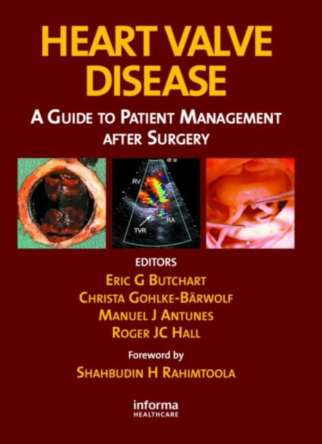 Book cover of: Heart Valve Disease