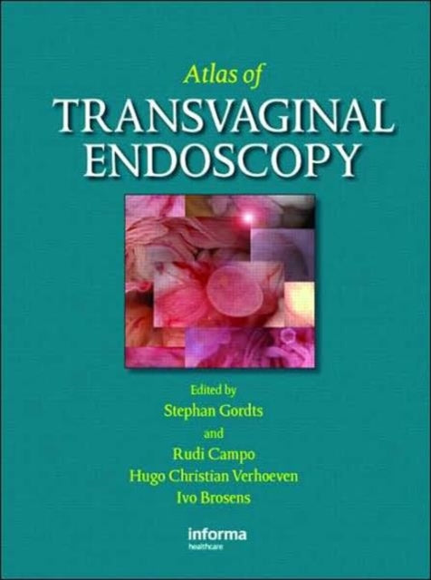 Book cover of: Atlas of Transvaginal Endoscopy