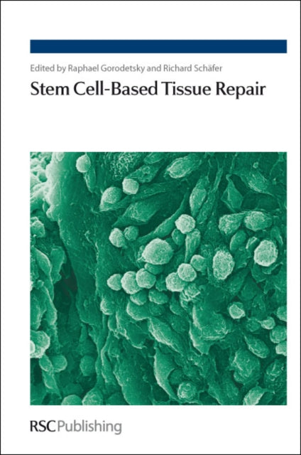 Book cover of: Stem Cell-Based Tissue Repair