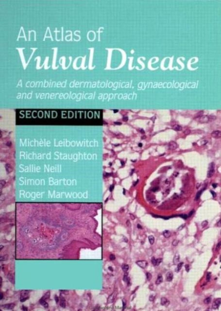Book cover of: Atlas of Vulval Diseases. By: Michelle Leibowitch