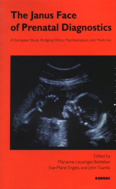 Book cover of: Janus Face of Prenatal Diagnostics. By: Marianne Leuzinger-Bohleber
