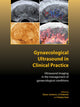 Book cover of: Gynaecological Ultrasound in Clinical Practice. By: Davor Jurkovic