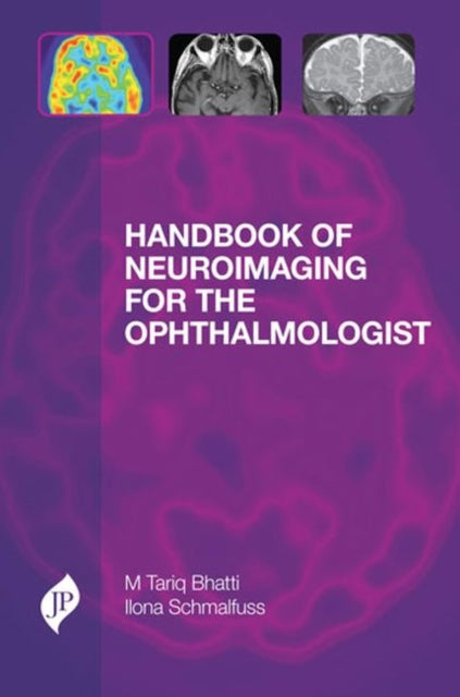 Book cover of: Handbook of Neuroimaging for the Ophthalmologist