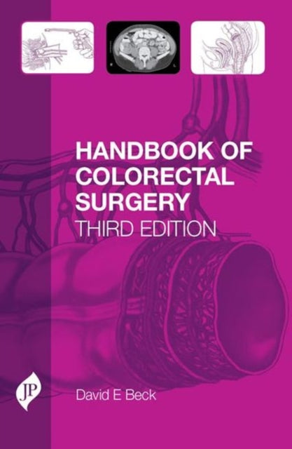 Book cover of: Handbook of Colorectal Surgery. By: David Beck