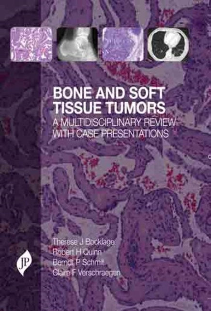 Book cover of: Bone and Soft Tissue Tumors. By: Therese J. Bocklage