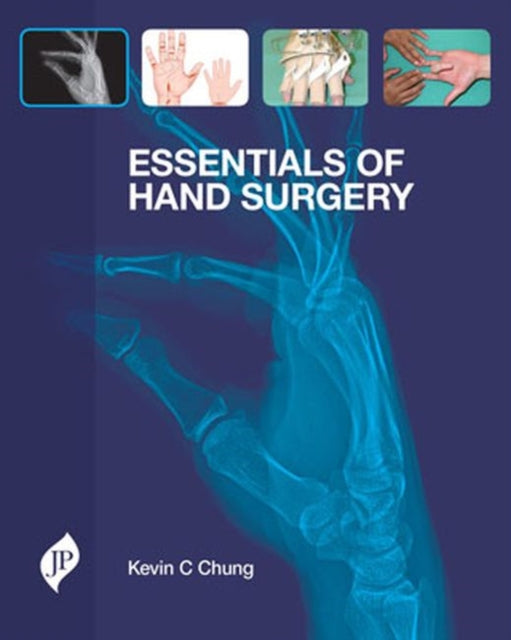 Book cover of: Essentials of Hand Surgery. By: Kevin C Chung