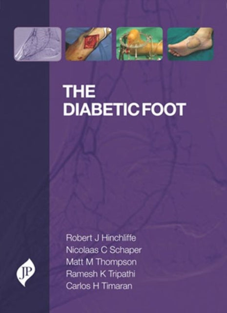 Book cover of: Diabetic Foot. By: Robert Hinchliffe