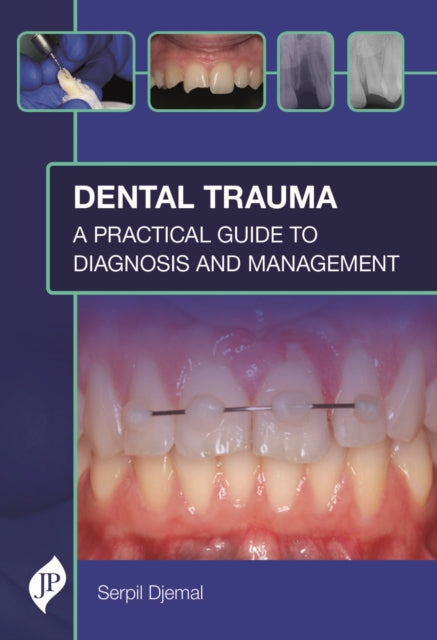 Book cover of: Dental Trauma. By: DJEMAL