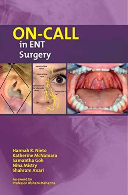Book cover of: On-Call in ENT Surgery. By: NIETO ET AL