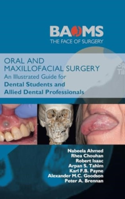 Book cover of: Oral and Maxillofacial Surgery. By: Chouhan AHMED