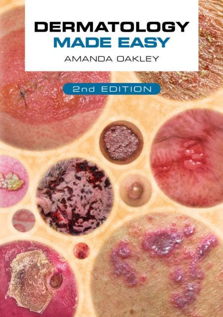 Book cover of: Dermatology Made Easy, second edition. By: Amanda Oakley