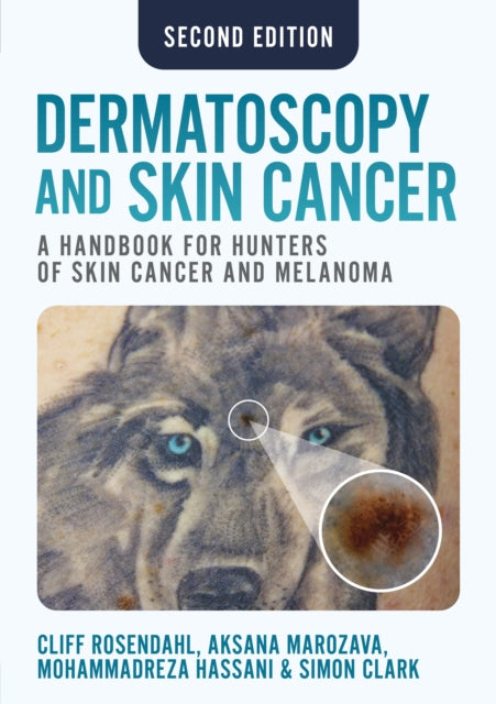 Book cover of: Dermatoscopy and Skin Cancer, second edition