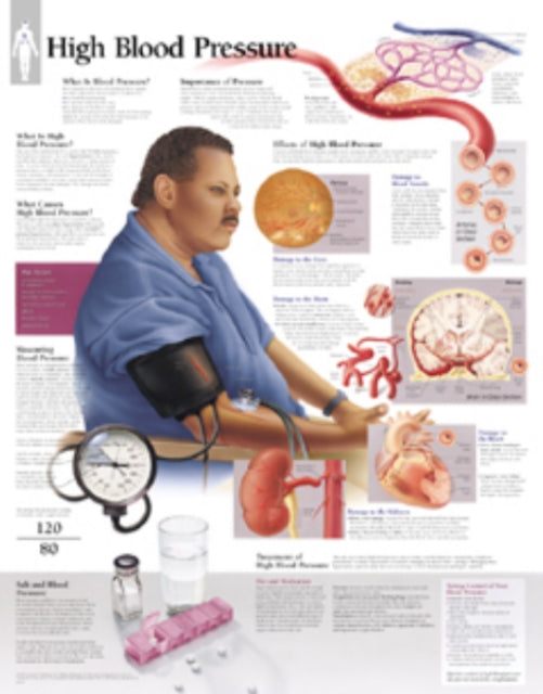 Book cover of: High Blood Pressure Paper Poster. By: Scientific Publishing