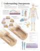 Book cover of: Understanding Osteoporosis Paper Poster. By: Scientific Publishing