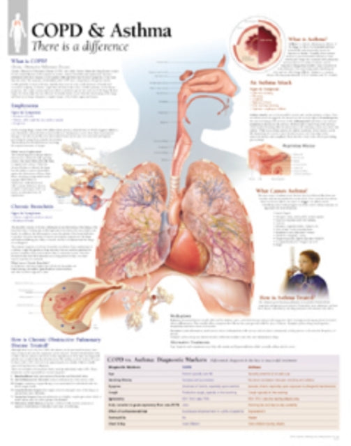 Book cover of: COPD & Asthma Paper Poster. By: Scientific Publishing