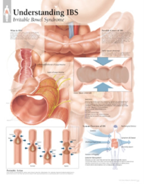 Book cover of: Understanding IBS Paper Poster. By: Scientific Publishing
