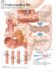Book cover of: Understanding IBS Paper Poster. By: Scientific Publishing
