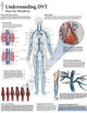 Book cover of: Understanding DVT Paper Poster
