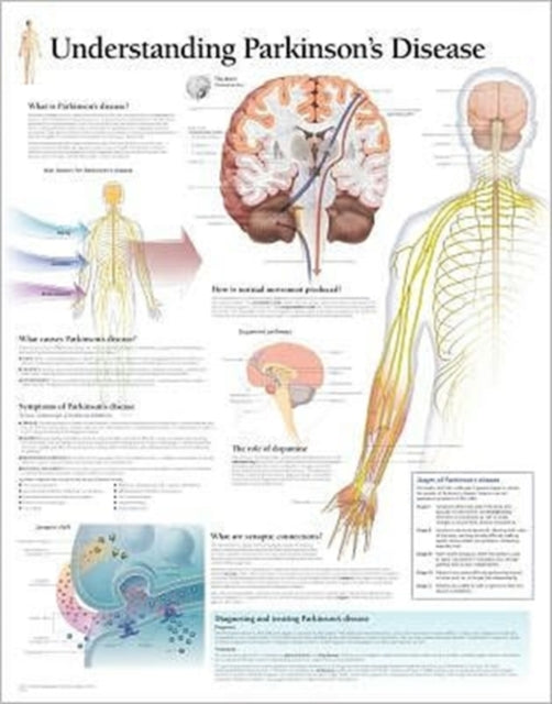 Book cover of: Understanding Parkinson's Laminated Poster. By: Scientific Publishing
