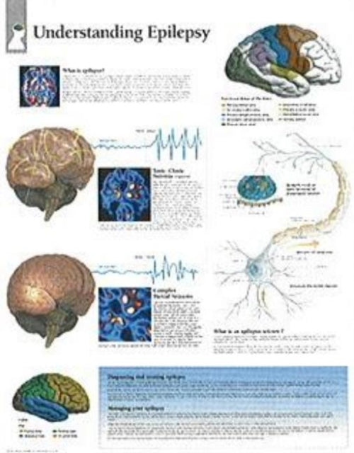 Book cover of: Understanding Epilepsy Laminated Poster. By: Scientific Publishing