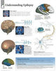 Book cover of: Understanding Epilepsy Paper Poster. By: Scientific Publishing