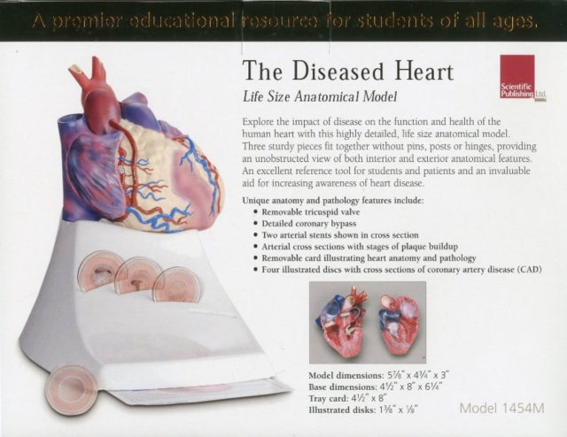 Book cover of: Life Size Diseased Heart Model