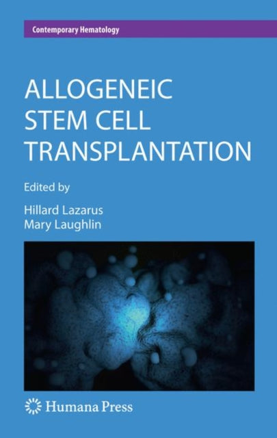 Book cover of: Allogeneic Stem Cell Transplantation. By: Mary J. Laughlin