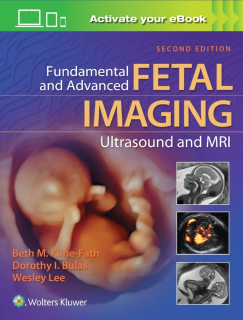 Book cover of: Fundamental and Advanced Fetal Imaging Ultrasound and MRI. By: Beth Kline-Fath MD