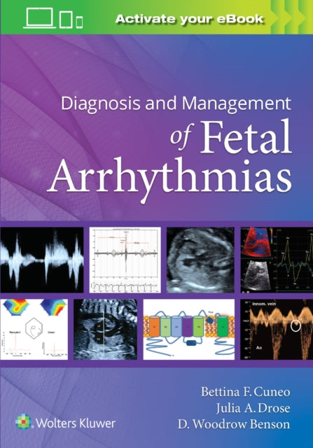 Book cover of: Diagnosis and Management of Fetal Arrhythmias. By: CUNEO
