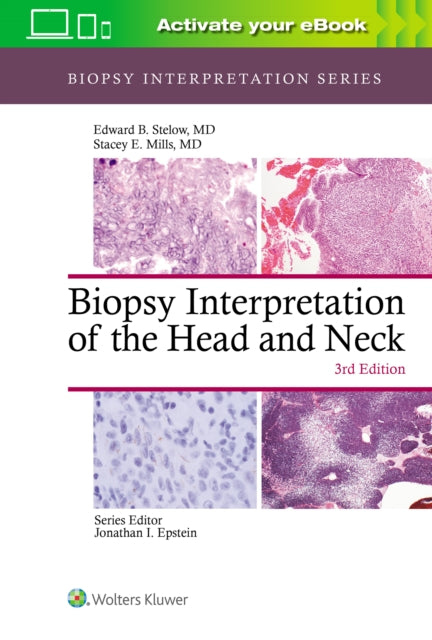 Book cover of: Biopsy Interpretation of the Head and Neck. By: Edward B. Stelow MD