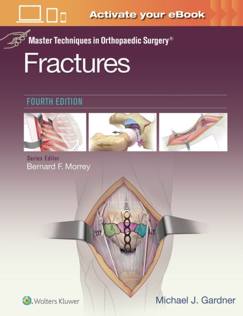 Book cover of: Master Techniques in Orthopaedic Surgery: Fractures. By: Michael J. Gardner MD