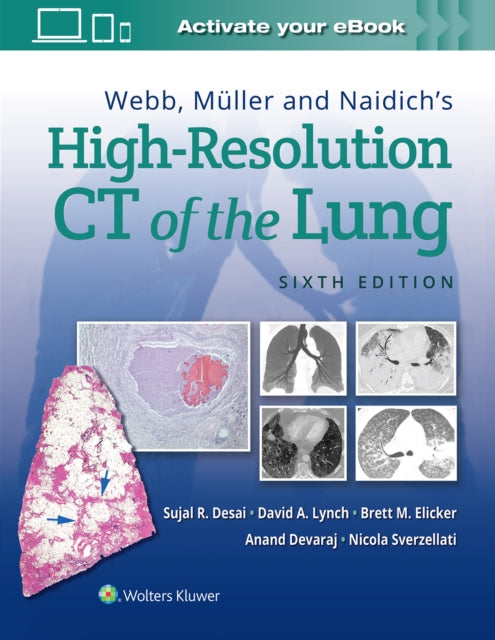 Book cover of: Webb, Muller and Naidich's High-Resolution CT of the Lung. By: Sujal Desai