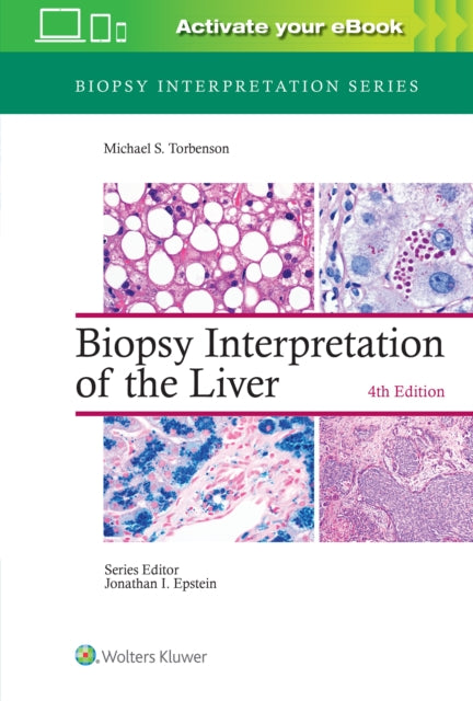 Book cover of: Biopsy Interpretation of the Liver. By: Michael Torbenson