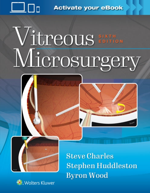 Book cover of: Vitreous Microsurgery. By: Steve Charles