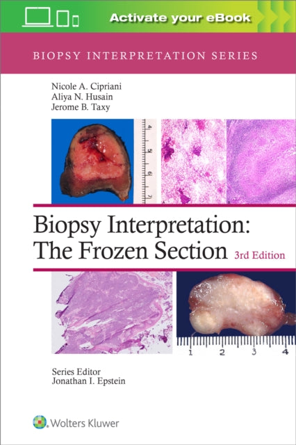 Book cover of: Biopsy Interpretation: The Frozen Section: Print + eBook with Multimedia. By: Nicole A. Cipriani