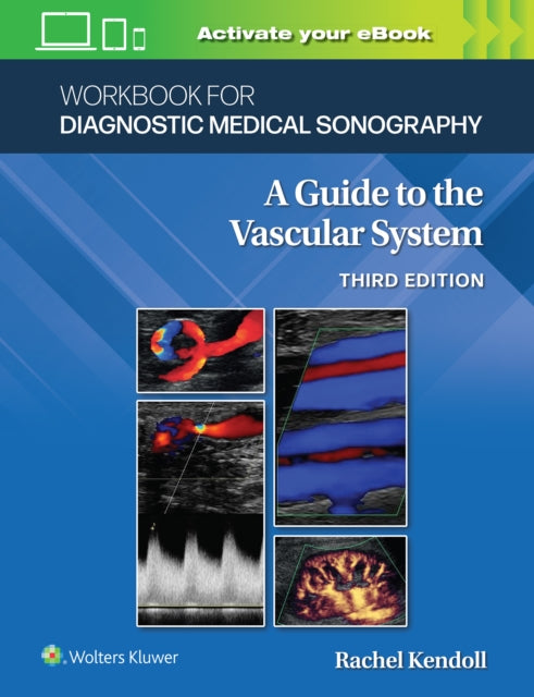 Book cover of: Workbook for Diagnostic Medical Sonography: The Vascular Systems. By: Ann Marie Kupinski