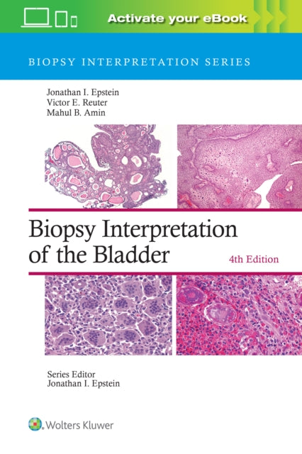 Book cover of: Biopsy Interpretation of the Bladder: Print + eBook with Multimedia. By: Jonathan I. Epstein
