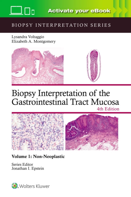 Book cover of: Biopsy Interpretation of the Gastrointestinal Tract Mucosa Volume 1. By: Lysandra VOLTAGGIO