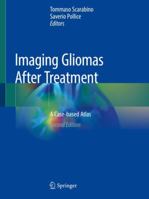 Book cover of: Imaging Gliomas After Treatment. By: Tommaso Scarabino