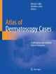 Book cover of: Atlas of Dermatoscopy Cases. By: Horacio Cabo