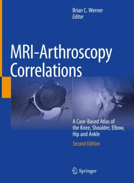 Book cover of: MRI-Arthroscopy Correlations. By: Brian C. Werner